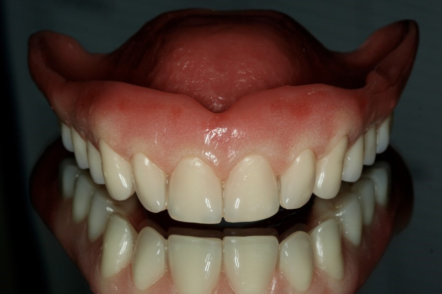 Young Dentures Before 
      And After Tyringham MA 1264